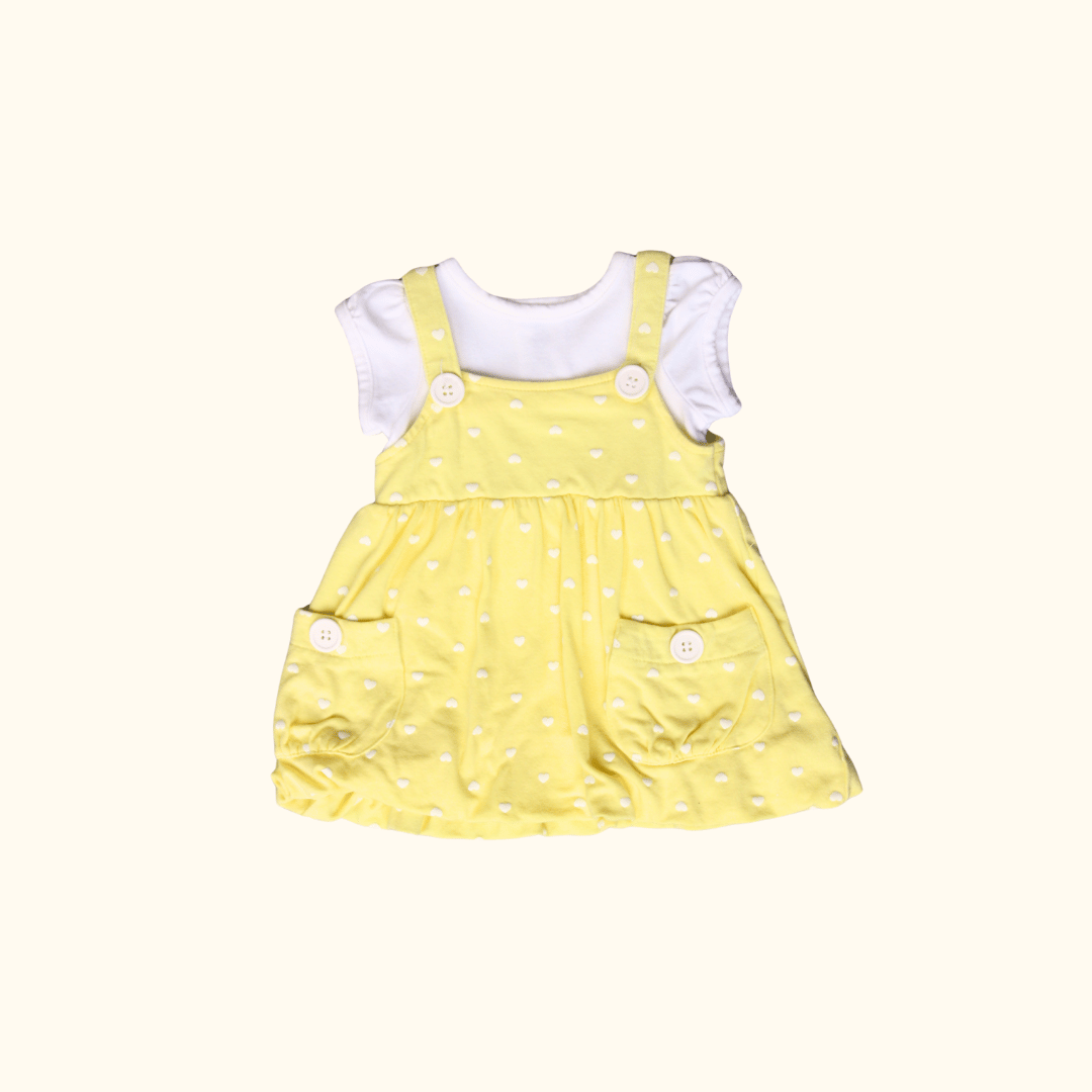 Yellow Dress with Heart Print