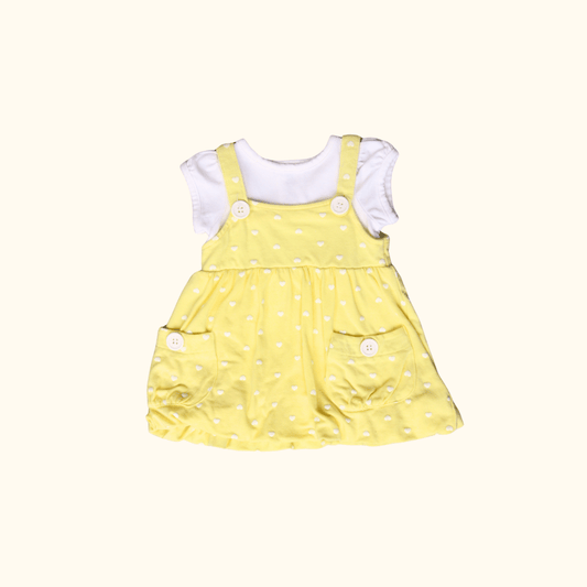 Yellow Dress with Heart Print